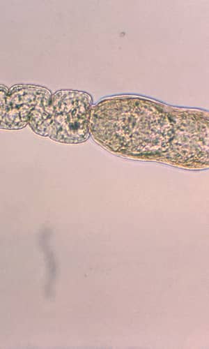 A Baraminic Study of the Blood Flukes  of Family Schistosomatidae