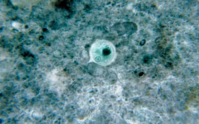 A Possible Function of Entamoeba histolytica in the Creation Model